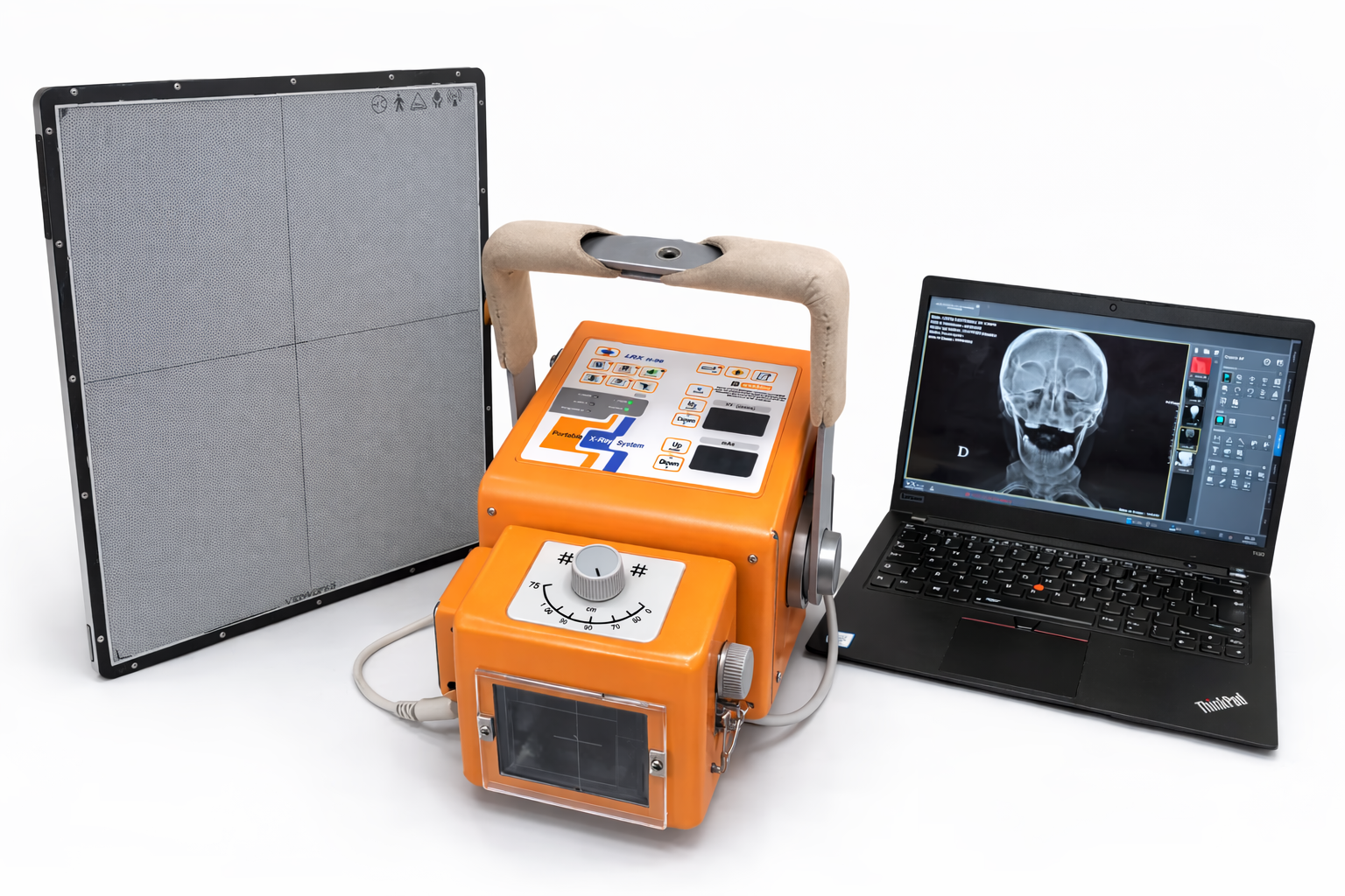 Equipamento portátil de raio-X digital com detector e notebook